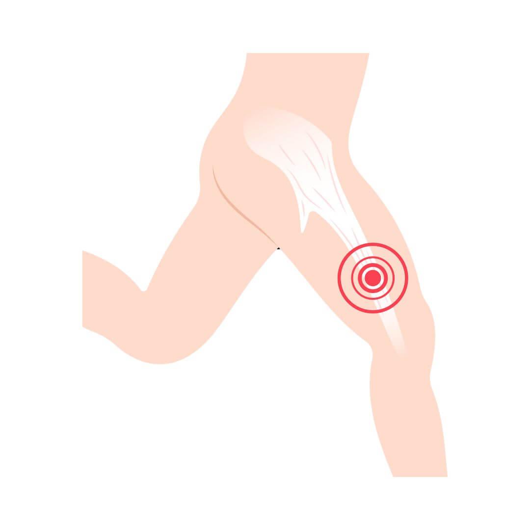 lopersknie illustratie