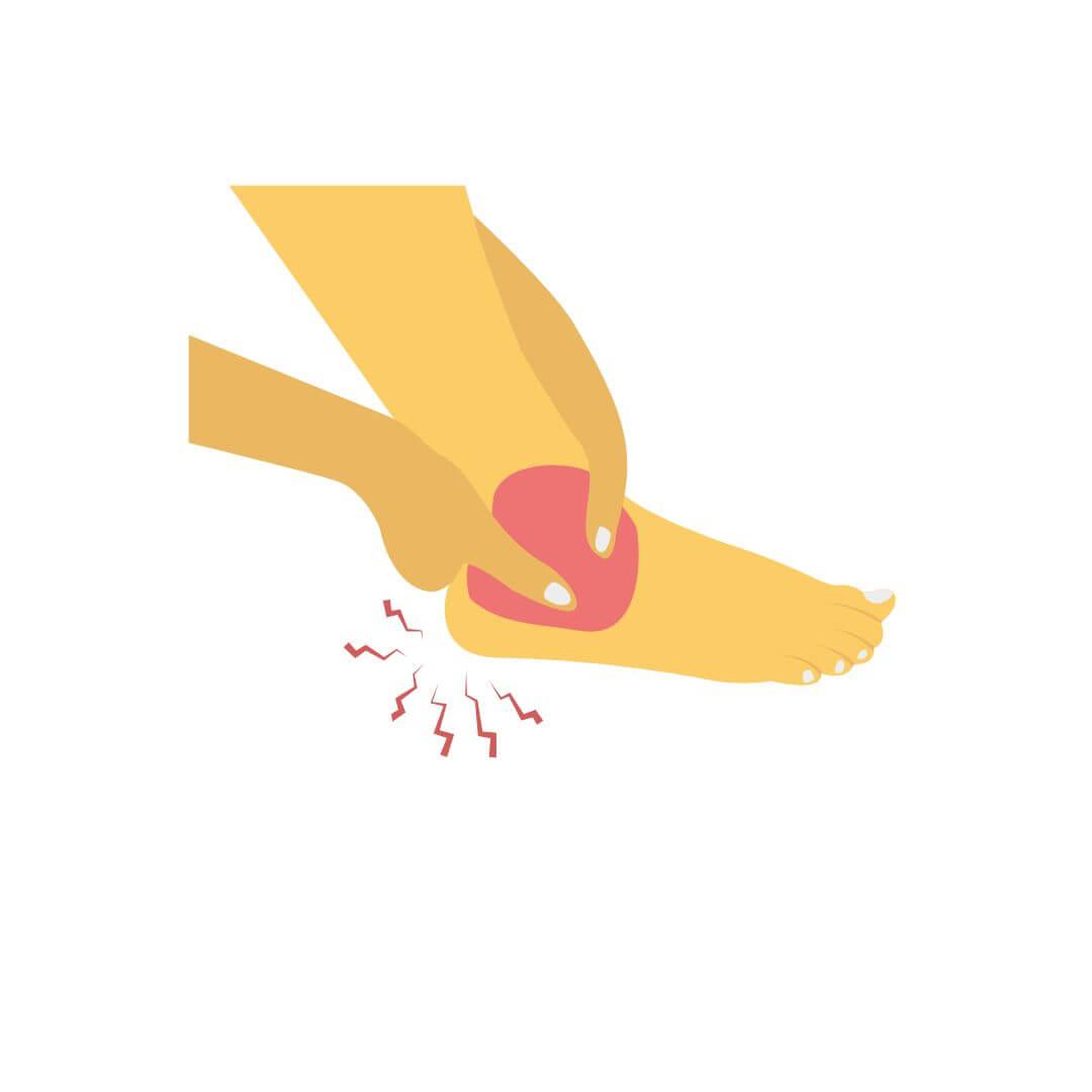 Neuropatische pijn illustratie