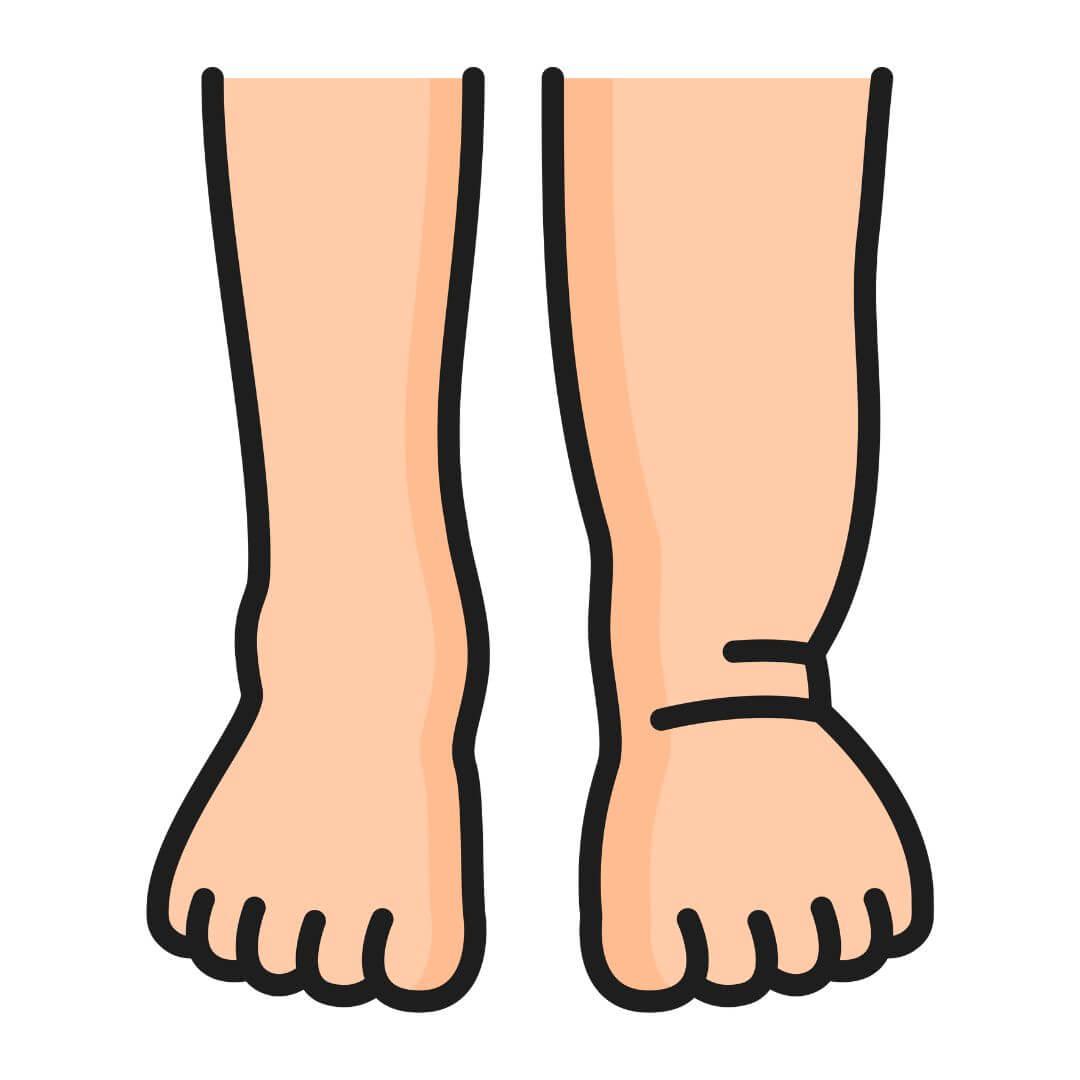 Vocht en zwelling illustratie