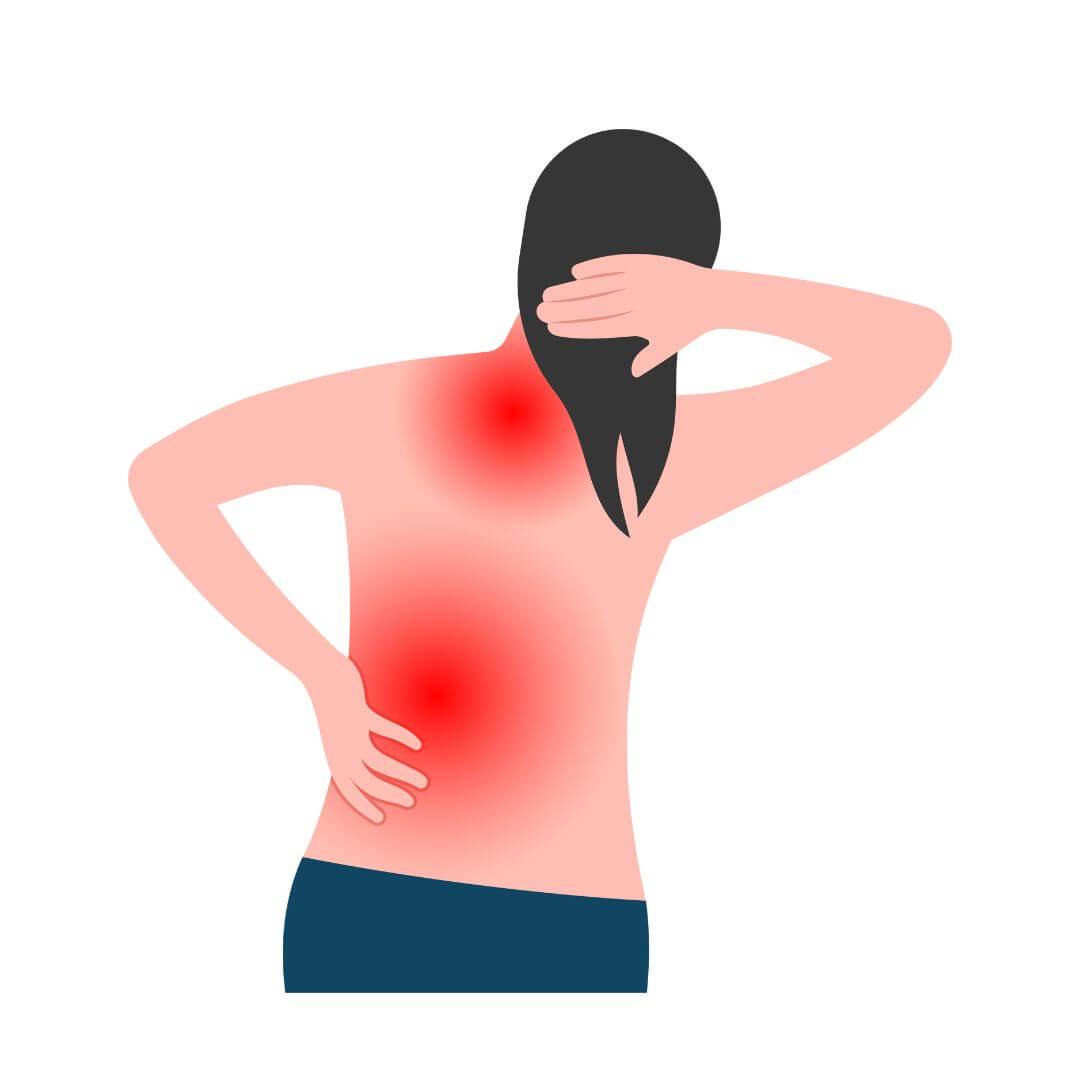 Illustratie fibromyalgie