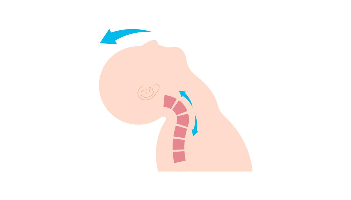 Whiplash illustratie